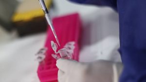 Quiénes se podrán vacunar en Chile contra la Viruela del Mono