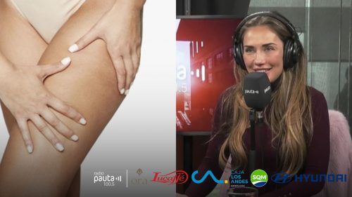 El método de kinesióloga chilena para combatir la celulitis: promete hasta un 70% de mejoría