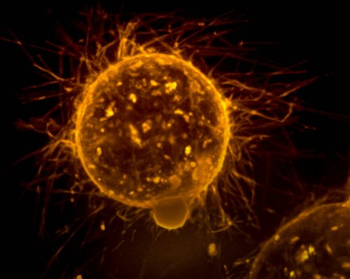 Científicos identifican "células madre mutantes" como origen del cáncer de pulmón