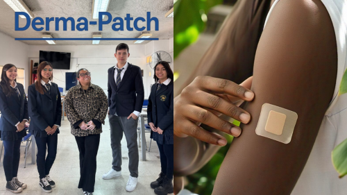 Derma-Patch: el parche que combate la deficiencia de vitamina D creado por estudiantes de tercero medio