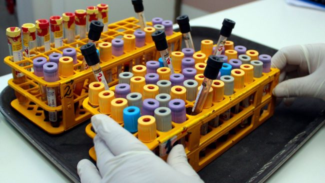 Minsal confirma detección en Chile del subclado K, variante del virus de la influenza A(H3N2)